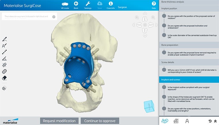 Screenshot of the Materialise SurgiCase software showing a 3D rendering of a pelvis with a blue aMace acetabular implant and screw placements. The interface includes a checklist for reviewing bone thickness analysis, implant position, bone preparation, screw details, and implant-and-screw compliance.