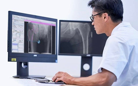 Healthcare professional looking at an X-ray in Materialise medical software on two computer screens